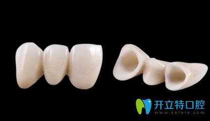 東莞美立方全瓷牙矯正