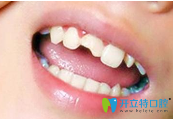煙臺拜博口腔牙齒修復(fù)