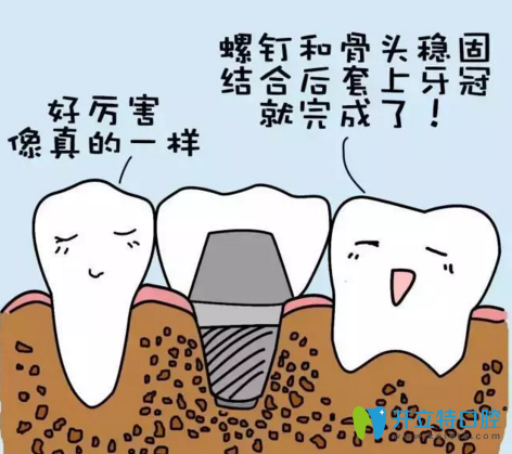 拜博口腔種植牙的介紹