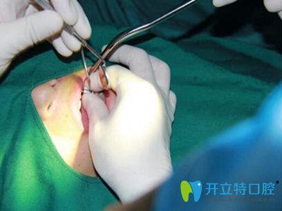 合肥佳德口腔牙齒種植案例 合肥佳德口腔牙齒種植案例