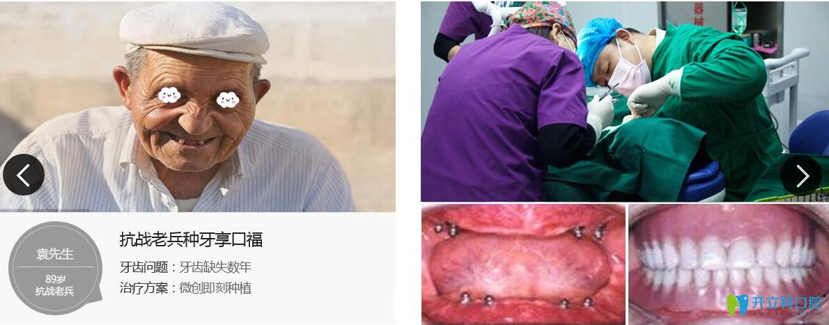 濟(jì)民口腔為牙齒缺失數(shù)年抗戰(zhàn)老兵做微創(chuàng)即刻種植