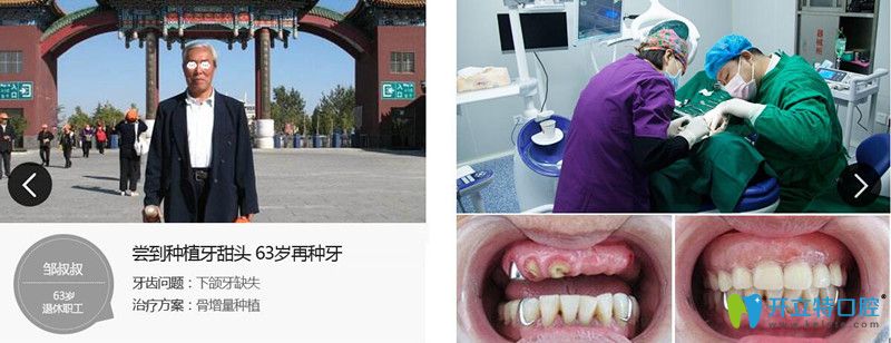 王繼民為下頜牙缺失者進(jìn)行牙齒種植