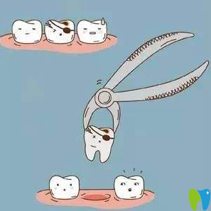 壞牙的情況 壞牙的情況