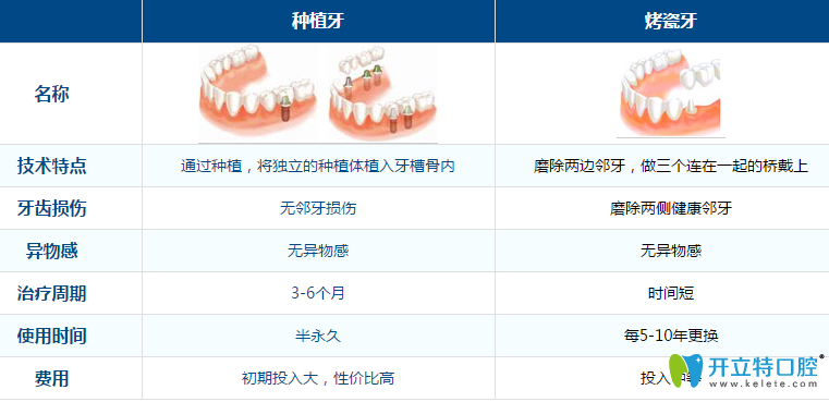 德陽(yáng)新橋口腔種植牙優(yōu)勢(shì)