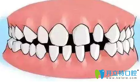 徐州博愛口腔牙頜畸形示意圖 徐州博愛口腔牙頜畸形示意圖