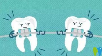 牙齒矯正后佩戴保持器圖示