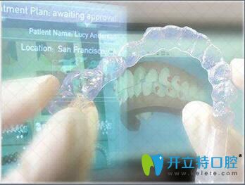 烏魯木齊美奧口腔門診數(shù)字化矯正系統(tǒng)優(yōu)勢
