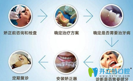 牙齒矯正注意事項(xiàng)