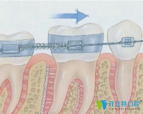 口腔正畸原理