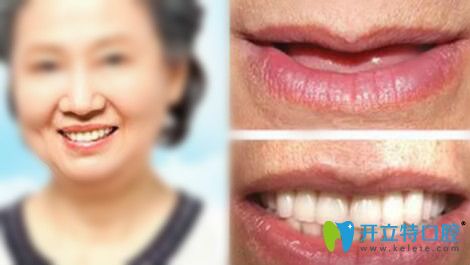 鄭州德貝口腔牙齒種植