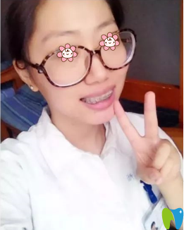 張小龍醫(yī)生給我做的牙齒矯正