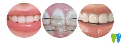 長(zhǎng)沙美萊口腔青少年正畸矯正