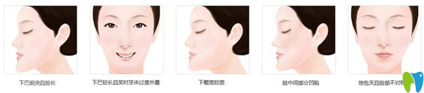 地包天的恢復(fù)過(guò)程