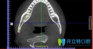 長沙美萊口腔牙齒矯正優(yōu)勢詳細測量數(shù)據(jù)