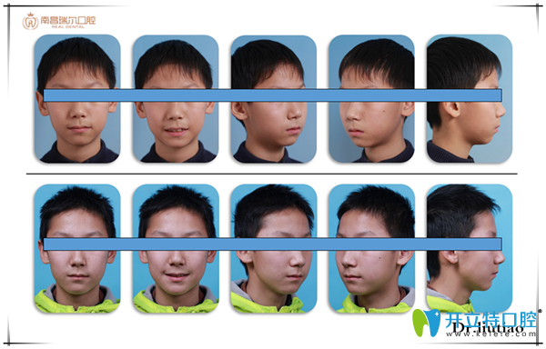 擁擠，單純排齊