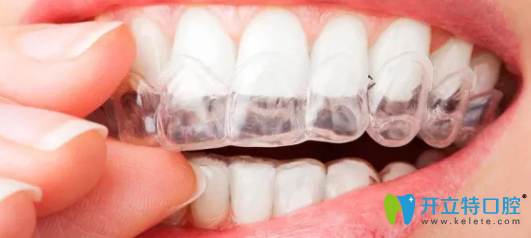 榆林長(zhǎng)虹口腔隱形牙齒矯正器 榆林長(zhǎng)虹口腔隱形牙齒矯正器