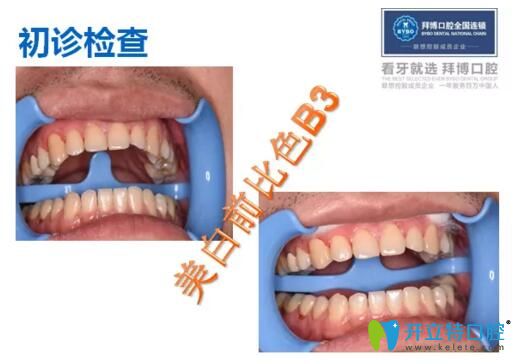 術(shù)前初診檢查結(jié)果