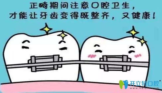 詳解牙齒矯正期間的飲食注意事項 讓你避開這7個錯誤習(xí)慣
