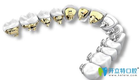 深圳河山齒科無(wú)托槽隱形矯正示例圖