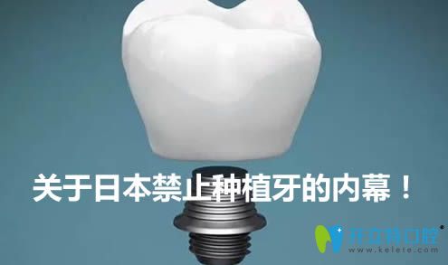 關(guān)于日本為什么停止種植牙的內(nèi)幕
