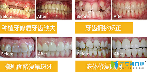 北京拜博口腔看牙效果好不好 北京拜博口腔看牙效果好不好