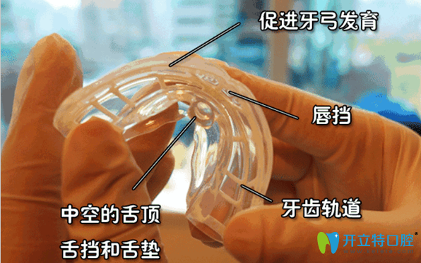 MRC肌功能矯治器的結(jié)構(gòu)和優(yōu)勢 MRC肌功能矯治器的結(jié)構(gòu)和優(yōu)勢