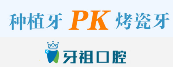 烤瓷牙和種植牙哪個好 長沙牙祖口腔詳述兩者的區(qū)別+優(yōu)劣勢