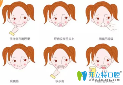 怎么判斷孩子是否需要MRC訓(xùn)練治療 怎么判斷孩子是否需要MRC訓(xùn)練治療