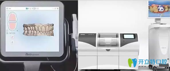 iTero口內(nèi)掃描儀優(yōu)勢介紹 iTero口內(nèi)掃描儀優(yōu)勢介紹