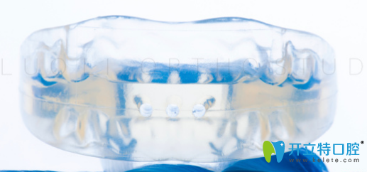 用過羅慕矯正的來點評:羅慕矯正器到底好不好,多少錢一套呢