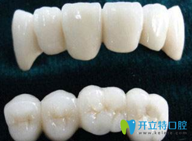 牙隱裂一定要做烤瓷牙修復嗎