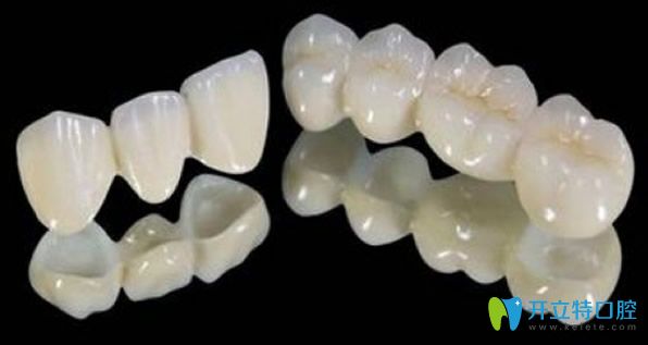 二氧化鋯全瓷牙形狀和顏色