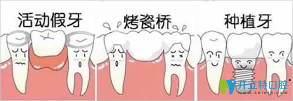 青島天皓口腔門診牙齒修復方式圖 青島天皓口腔門診牙齒修復方式圖