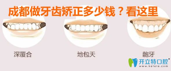 成都做牙齒矯正的價格是多少錢