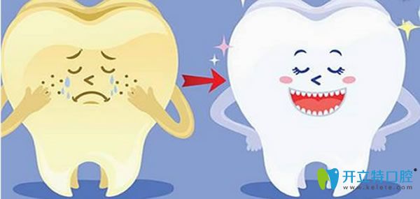 黃牙怎么變白答案揭曉 要想擁有潔白貝齒搶先看