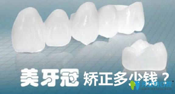 美容冠牙齒矯正大概需要多少錢?請看本文提供的價格一覽表