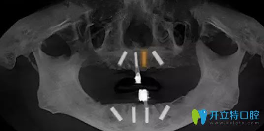 口腔檢查后 口腔檢查后