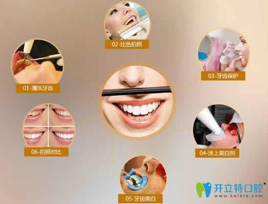  牙黑牙黃做牙齒冷光美白多少錢?國(guó)內(nèi)全新價(jià)格及注意事項(xiàng)