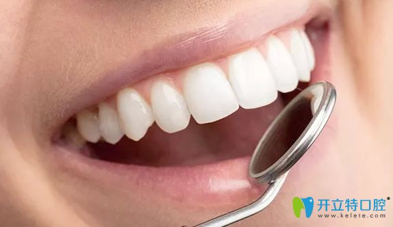 冷光美白牙齒多少錢一次 冷光美白牙齒多少錢一次
