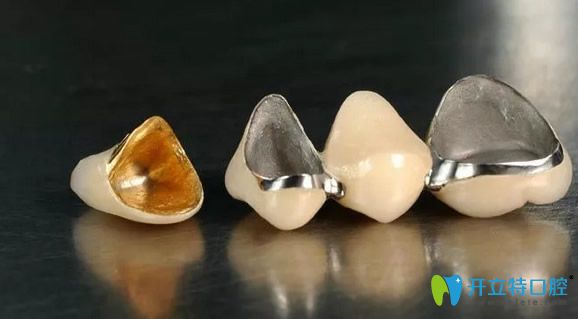 烤瓷牙和全瓷牙是美白牙齒的有效方式 烤瓷牙和全瓷牙是美白牙齒的有效方式