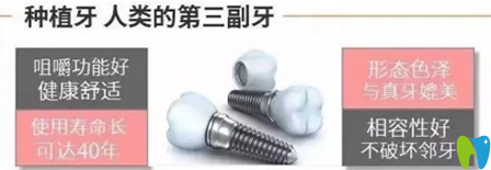 種植牙優(yōu)勢有哪些