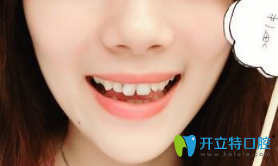 在做牙齒正畸前