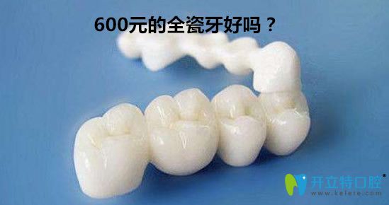 600元的全瓷牙好嗎？全瓷牙套1000一顆貴嗎