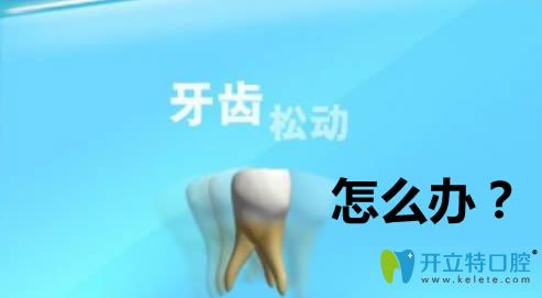 牙齒松動(dòng)怎么治療？做修復(fù)的話價(jià)格大概需要多少錢？