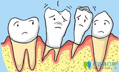 牙齒松動修復的價格需要多少錢