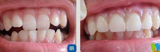 天津美萊口腔高志永怎么樣？真人案例及反饋來嘍