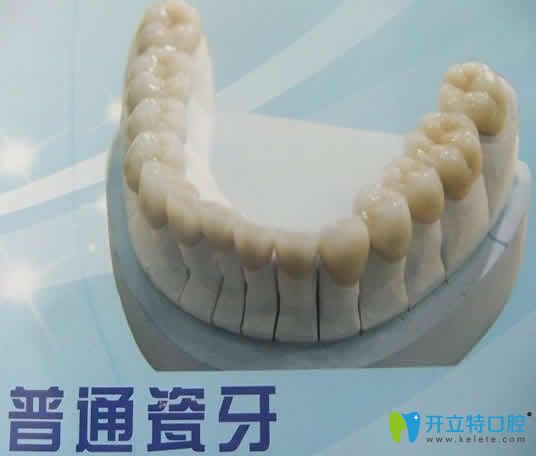 普通烤瓷牙多少錢一顆及能用多久 點(diǎn)擊這里有你想知道的