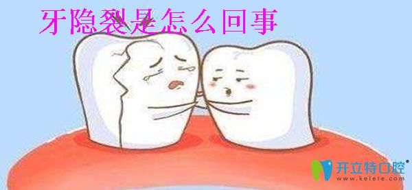 牙隱裂治療多少錢 有沒有想過牙齒裂縫怎么回事能撐幾年