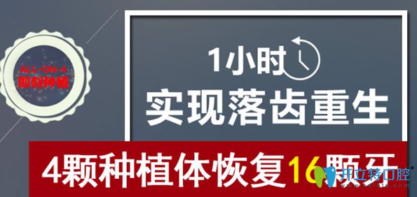All-on-4即刻種植牙優(yōu)勢(shì)