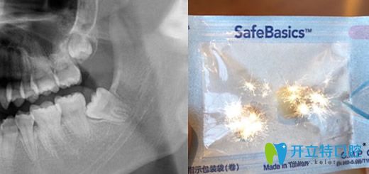 <!--<i data=20240703-sp></i>-->口腔朝陽北路拔智齒